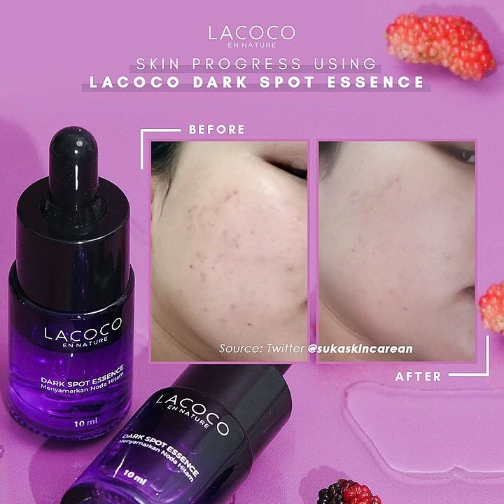 Skin Progress Lacoco Dark Spot Essence